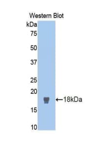 NOS1 / nNOS Antibody (aa9-136)