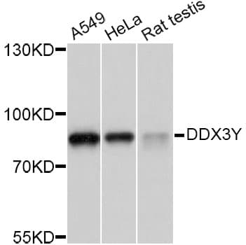 Polyclonal Rabbit anti-Human DDX3Y Antibody (IHC, WB)