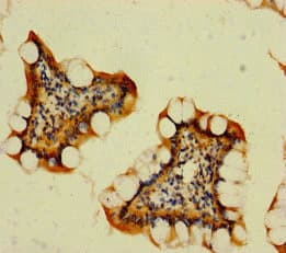 RNF125 / TRAC-1 Antibody