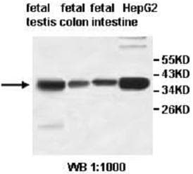 Polyclonal Rabbit anti-Human AKR1D1 Antibody (aa73-315, IHC, WB)
