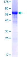 Human HNRNPF / hnRNP F Protein (Recombinant GST)