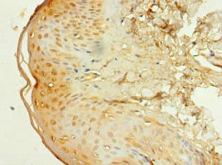 EP300 / p300 Antibody