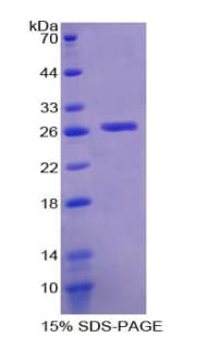 Mouse GSTT2 Protein (Recombinant His-T7)