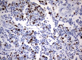 Monoclonal Mouse anti-Human MKI67 / Ki67 Antibody (clone OTI14G1, aa1160-1493, IHC)