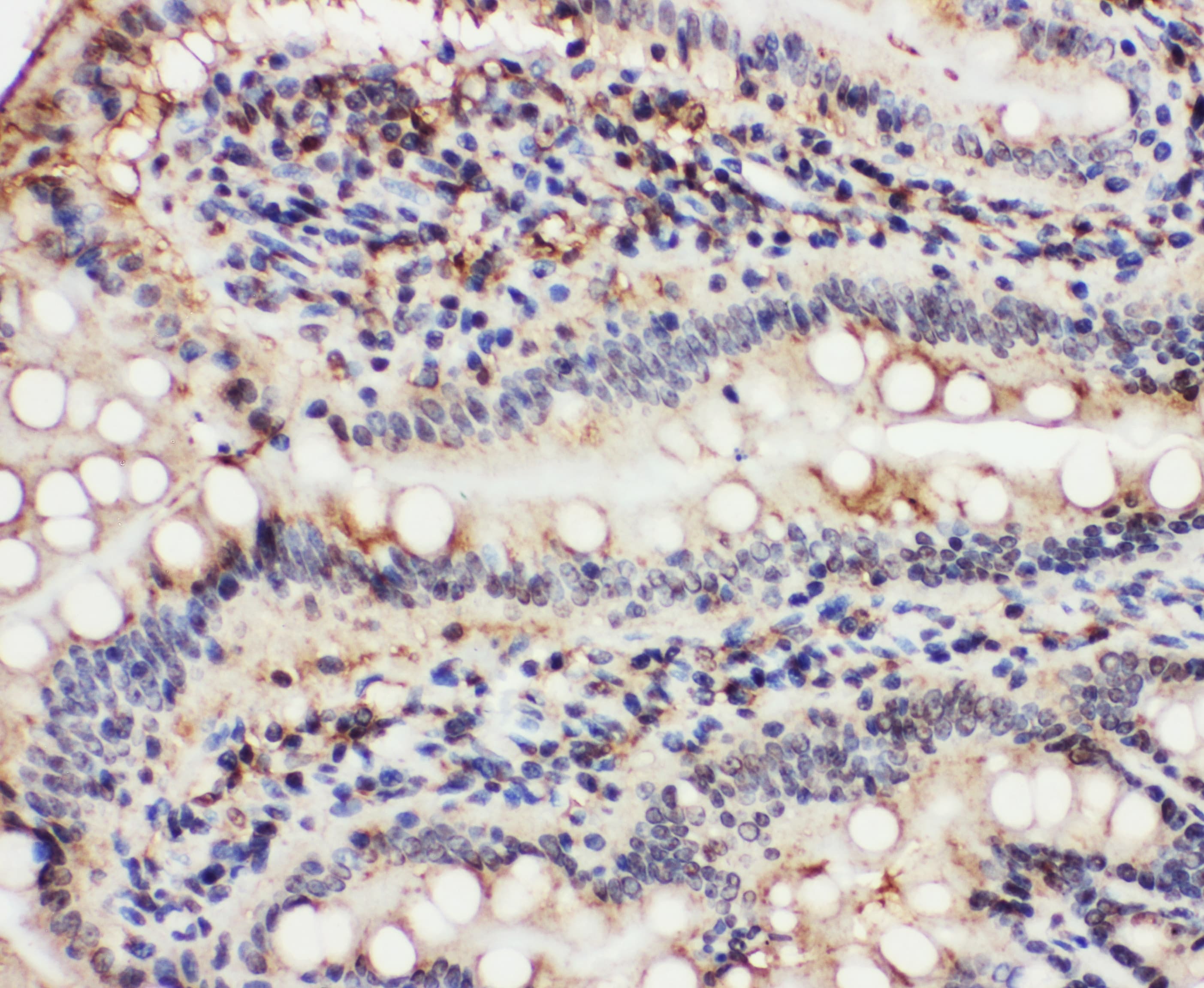 Polyclonal Rabbit anti-Human VCP Antibody (aa749-766, IHC, WB)