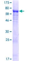 Human ALDH1L2 Protein (Recombinant GST)
