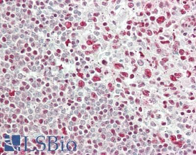 IHC-plus™ Polyclonal Rabbit anti-Human RBM25 / SNU71 Antibody (aa475-525, IHC, WB)