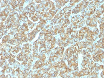 EPCAM Antibody (N-Terminus, aa 20-60, clone EGP40/1555R)