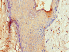 Polyclonal Rabbit anti-Human ALOX15B / 15-LOX-2 Antibody (aa1-200, IHC)