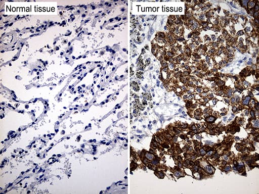 TRIM29 Antibody (aa1-352, clone OTI5C11)