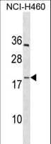 Polyclonal Rabbit anti-Human PF4V1 Antibody (aa77-104, WB)