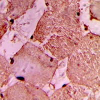 MYLIP / IDOL Antibody (Internal)