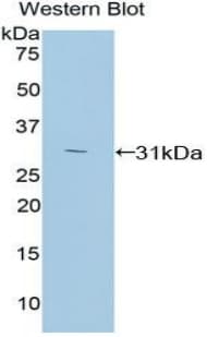 PRKCZ / PKC-Zeta Antibody (aa254-484)