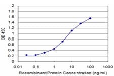 BRD3 Antibody (clone 7G6)