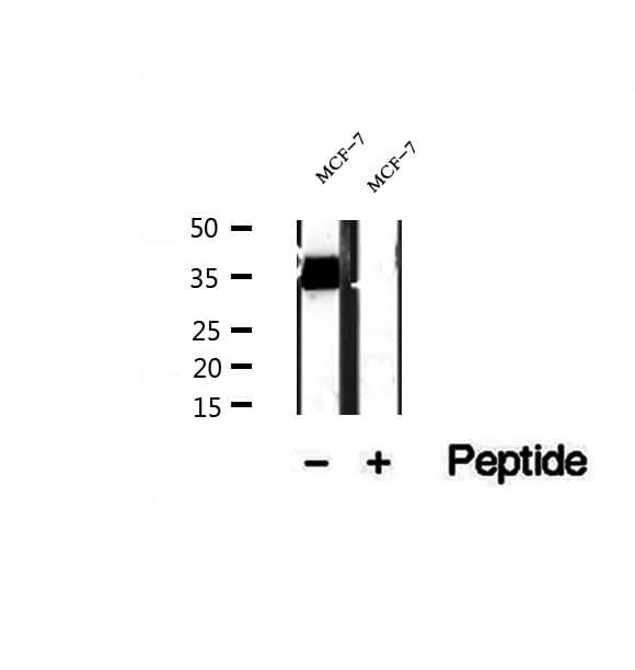 Polyclonal Rabbit anti-Human RCD1 / RQCD1 Antibody (IHC, WB)