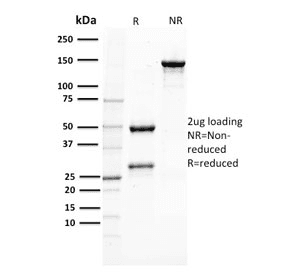 Monoclonal Mouse anti-Human PMEL / SILV / gp100 Antibody (clone PMEL/2037, IHC)