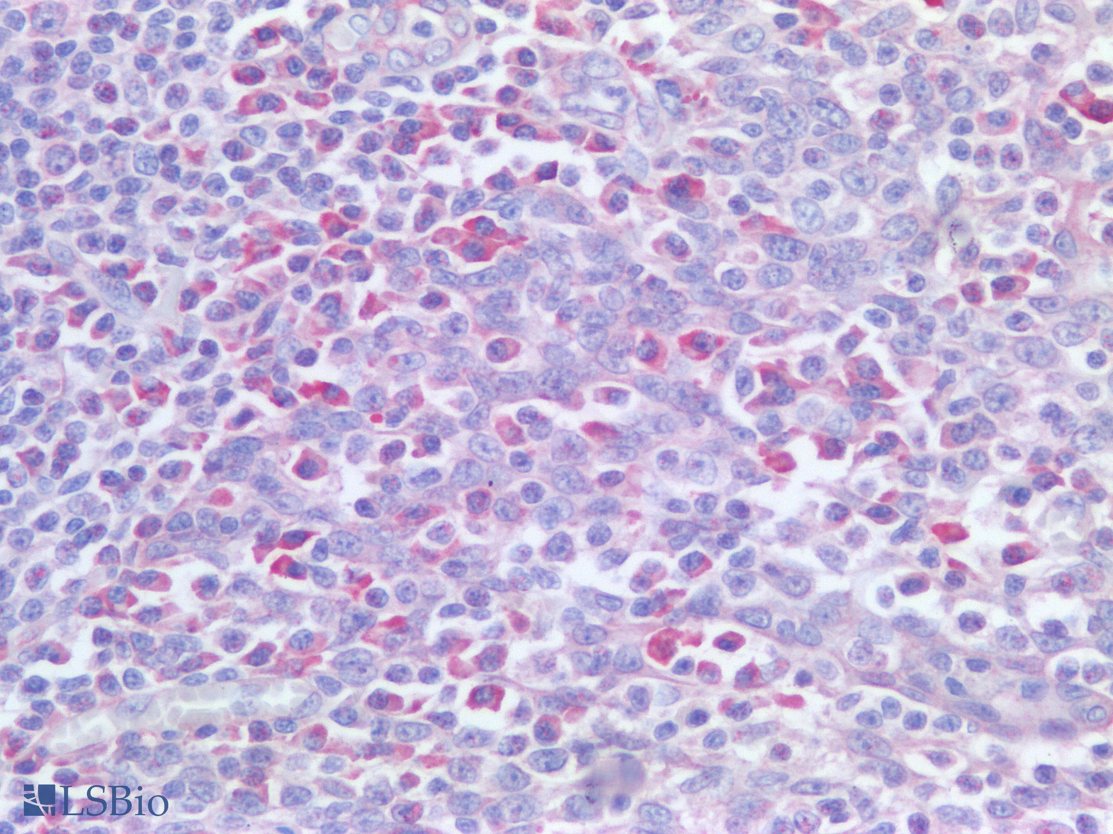 IHC-plus™ Polyclonal Rabbit anti-Human PDCD1 / CD279 / PD-1 Antibody (IHC)