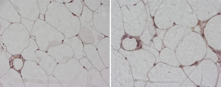 Adiponectin Antibody