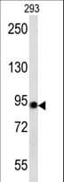 IHC-plus™ ACO2 / Aconitase 2 Antibody (aa438-467)