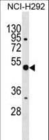 ANXA10 / Annexin A10 Antibody (aa274-300)
