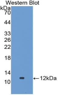 GPT2 / ALT2 Antibody (aa210-300, PE)