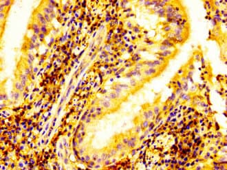 ELK3 / NET Antibody