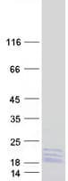 Human RPL14 / Ribosomal Protein L14 (Recombinant Myc-DDK (Flag))