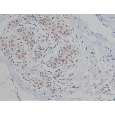 MAPT / Tau Antibody (phospho-Thr231)