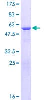Human FGFR1OP2 Protein (Recombinant GST)