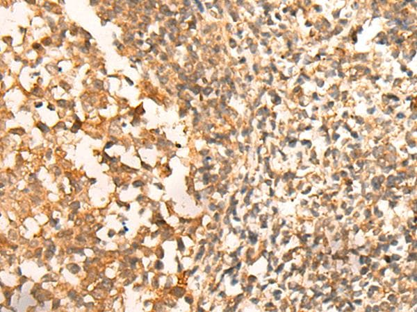 Polyclonal Rabbit anti-Human Translokin / CEP57 Antibody (IHC, WB)