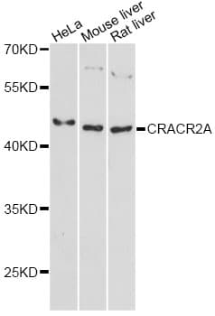 Polyclonal Rabbit anti-Human CRACR2A / EFCAB4B Antibody (WB)