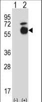 ALK2 / ACVR1 Antibody (aa137-166)
