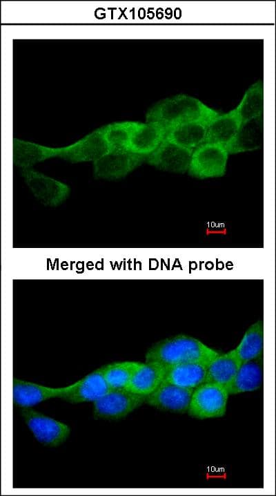 IKBKB / IKK2 / IKK Beta Antibody (aa493-739)