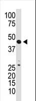 GDF3 Antibody (aa21-52)