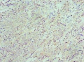 Polyclonal Rabbit anti-Human XIAP Antibody (aa1-200, IHC, WB)