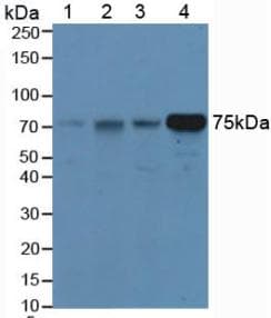 HPX / Hemopexin Antibody (aa31-242)