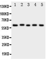 ACCN3 / ASIC3 Antibody (aa56-73)