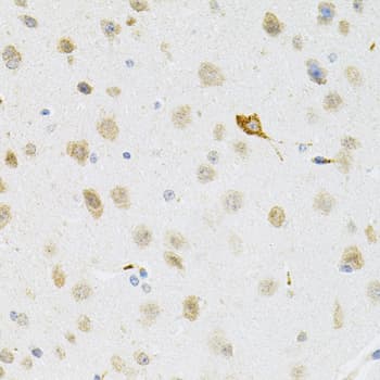 Polyclonal Rabbit anti-Human SYK Antibody (IHC, WB)