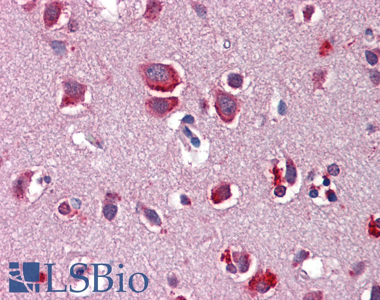 Polyclonal Rabbit anti-Human WNT7B Antibody (aa215-264, IHC, WB)