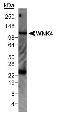 WNK4 Antibody (aa200-300, DY488)