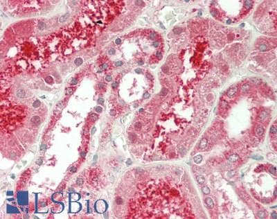 IHC-plus™ ASL / Argininosuccinate Lyase Antibody (aa86-325)