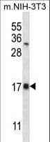 SELK / Selenoprotein K Antibody (aa32-61)