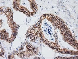 CTNNB1 / Beta Catenin Antibody (clone OTI1B11)