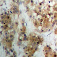 APC Antibody (Internal)