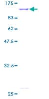 Human IMMT / Mitofilin Protein (Recombinant GST)