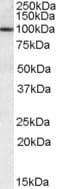 IHC-plus™ GOB5 / CLCA1 Antibody (aa872-884)