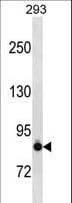 Polyclonal Rabbit anti-Human CDH6 / K Cadherin Antibody (aa61-89, IHC, WB)