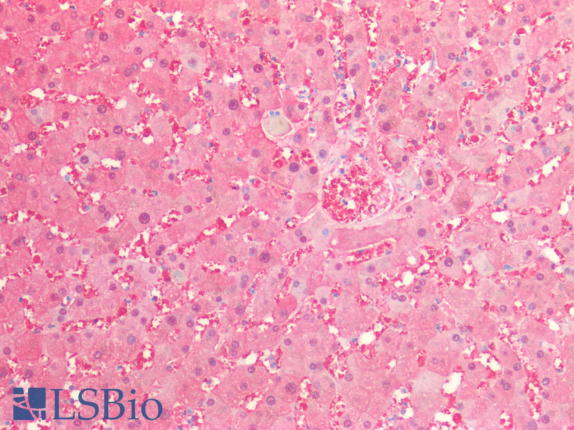 PathPlus™ ALDH1A1 / ALDH1 Antibody
