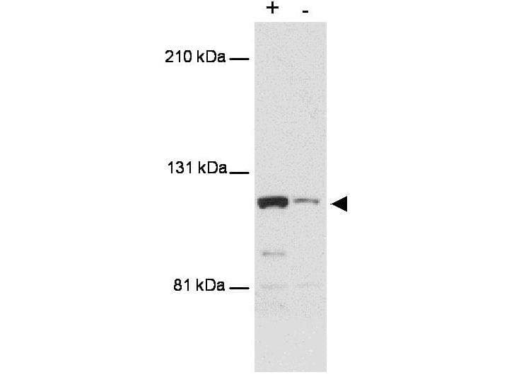 Monoclonal Mouse anti-Human MTBP / Mdm2-Binding Protein Antibody (clone PHL-1, aa667-812, WB)