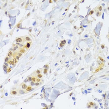 RELA / NFKB p65 Antibody